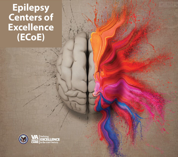 epilepsy head picture