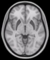 Sample of MRI image